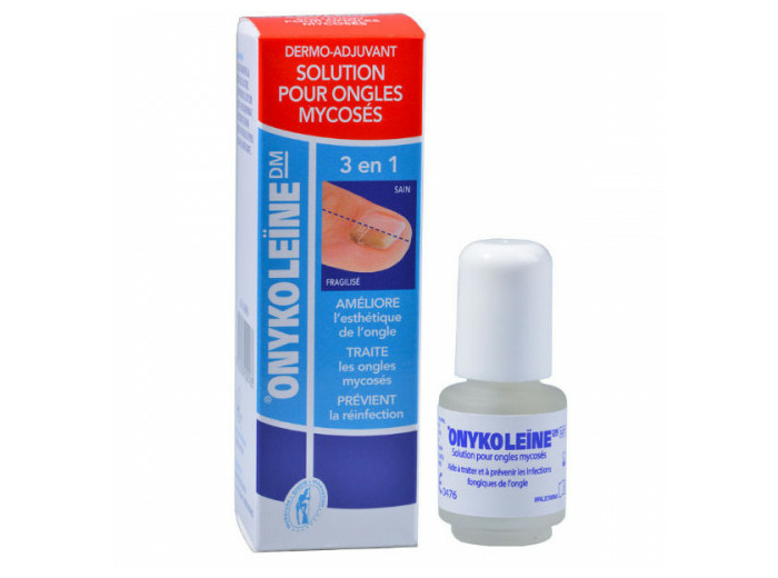 ONYKOLEINE SOL ONG MYC FL4ML 1