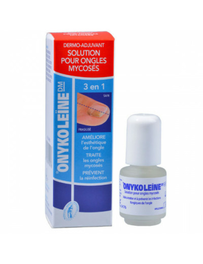 ONYKOLEINE SOL ONG MYC FL4ML 1