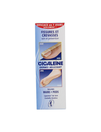 CICALEINE CR RESTRUCT   PIEDS/TALON T 30M